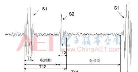 基于PSoC4的可视化心音采集系统 - 鹿快