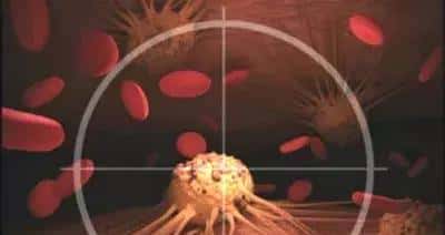 「重磅发布」肿瘤是一种代谢性疾病
