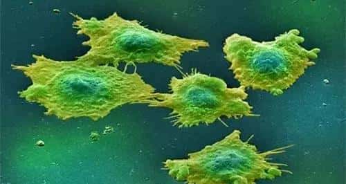 「重磅发布」肿瘤是一种代谢性疾病