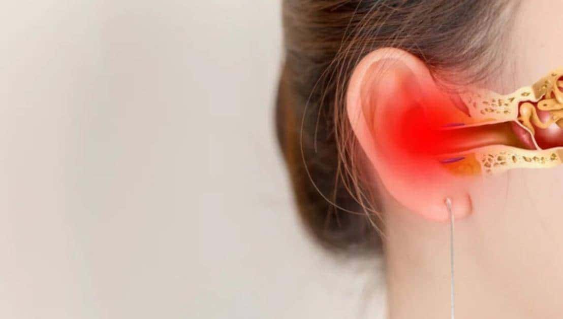 2022骨传导耳机哪个牌子好?一文读懂:如何选择骨传导耳机