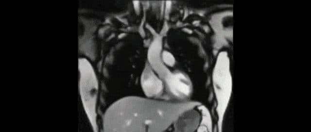 视频分割大结局！浙大发布SAM-Track：通用智能视频分割一键直达