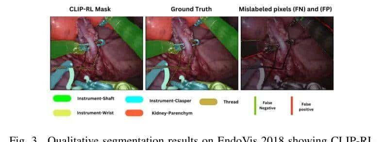 超越U-Net/TransUNet！融合CLIP与强化学习的分割模型凭什么性能翻倍？