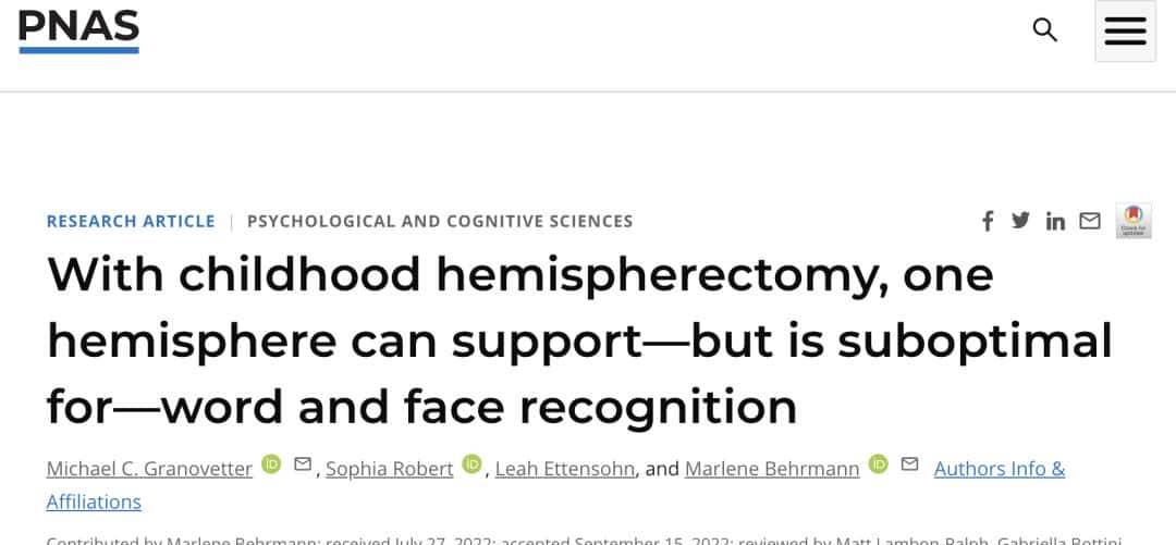 只剩半个大脑，人识字看脸准确率竟还能达80% | PNAS