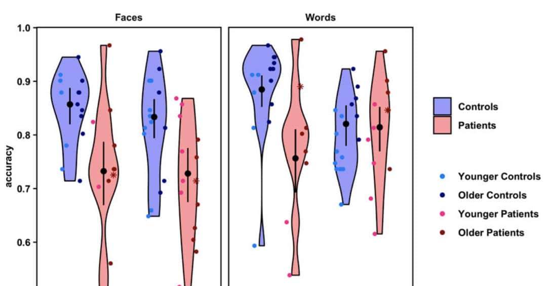 只剩半个大脑，人识字看脸准确率竟还能达80% | PNAS